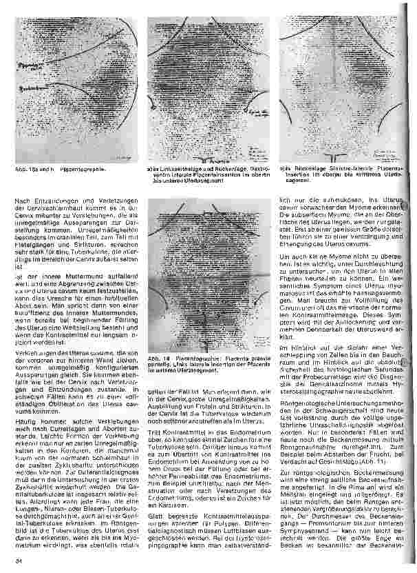 Vorschauseite 5: Radiologie Eine Einführung für Krankenschwestern u.Krankenpfleger 28. Folge:Röntgenologische Untersuchungen der weiblichen Genitalorgane