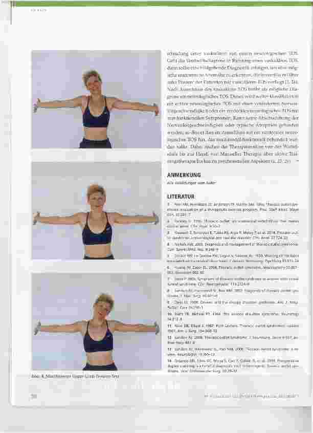 Vorschauseite 4: Thoracic-outlet-Syndrom