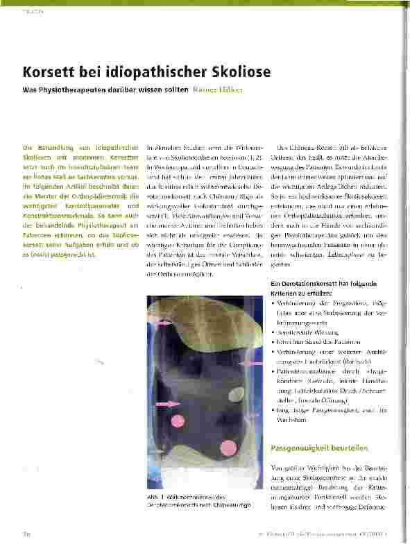Vorschauseite 1: Korsett bei idiopathischer Skoliose