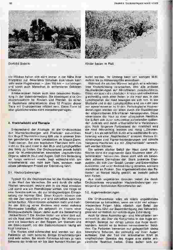 Vorschauseite 4: Die Onchozerkose und ihre Bekämpfung in Westafrika - Eine Aufgabe für die Entwicklungshilfe