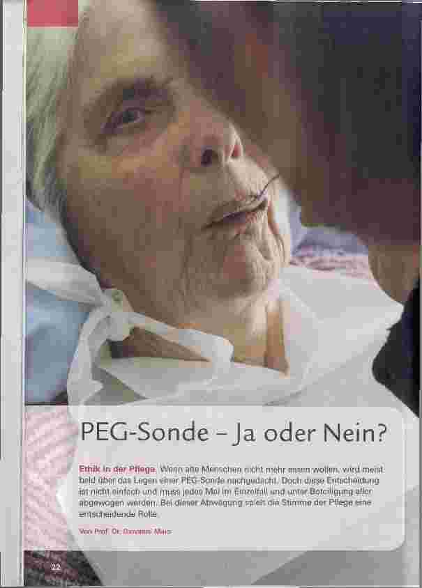 Vorschauseite 1: PEG-Sonde Ja oder Nein?