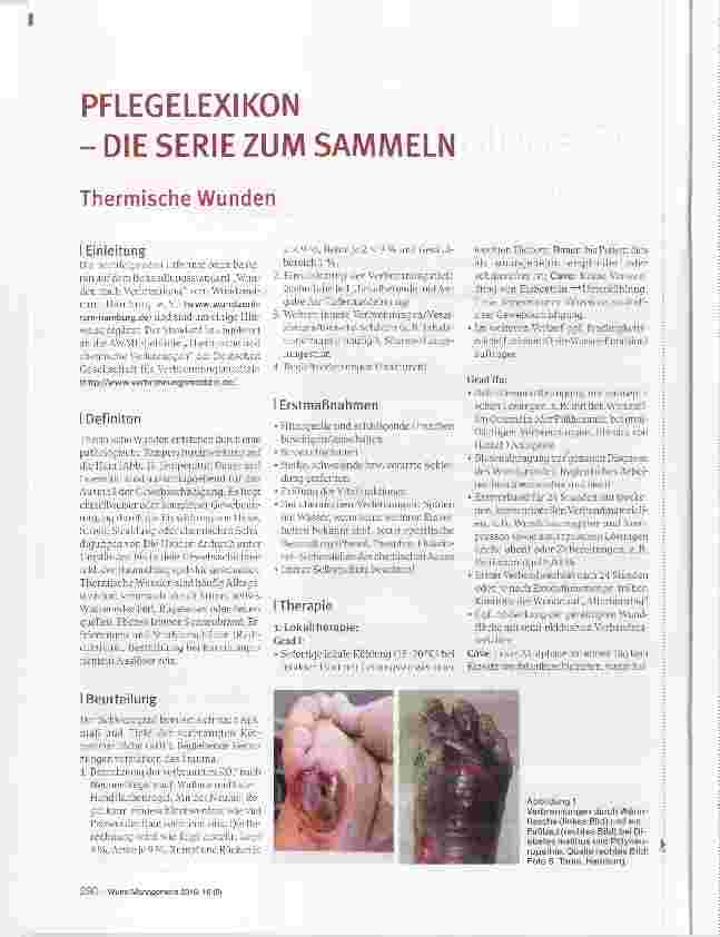 Vorschauseite 1: Thermische Wunden