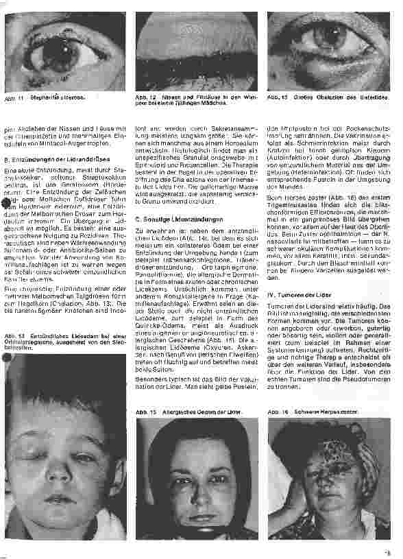 Vorschauseite 4: Einführung in die Augenheilkunde 4. Folge: Erkrankungen der Lider