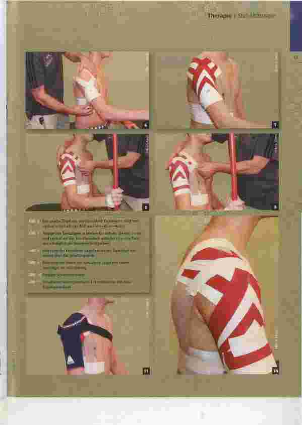 Vorschauseite 4: Schultertape Step-by-step