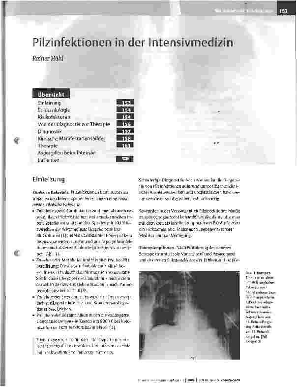 Vorschauseite 1: Pilzinfektionen in der Intensivmedizin
