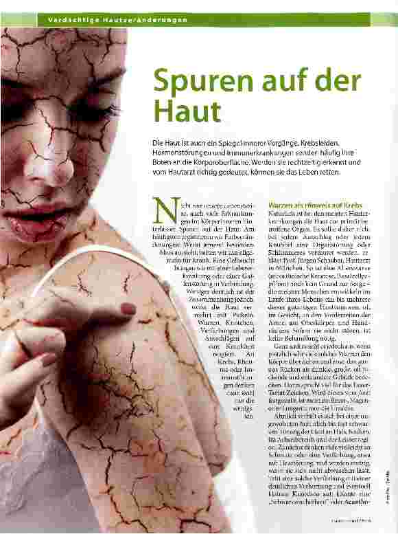 Vorschauseite 1: Spuren auf der Haut