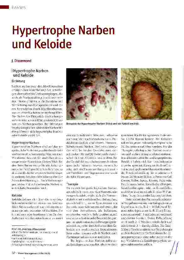 Vorschauseite 1: Hypertrophe Narben und Keloide