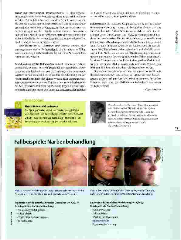 Vorschauseite 4: Narbenbehandlung Therapie, die unter die Haut geht