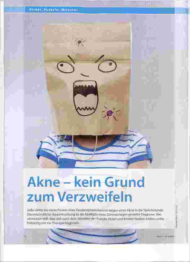 Vorschauseite 1: Akne kein Grund zum Verzweifeln