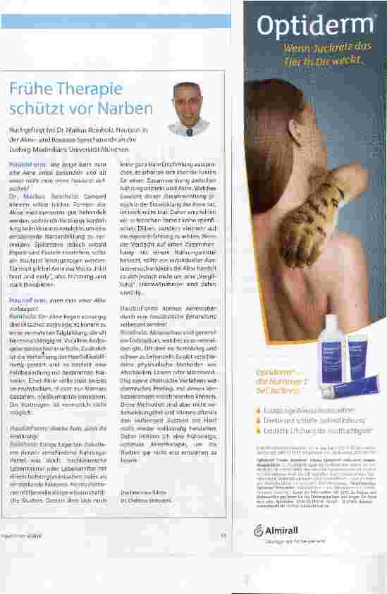 Vorschauseite 4: Akne kein Grund zum Verzweifeln