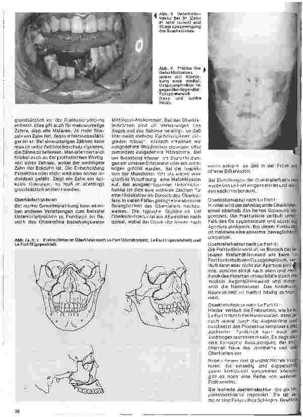 Vorschauseite 3: Zahn-Mundund Kieferchirurgie 8. Folge: Traumatologie I