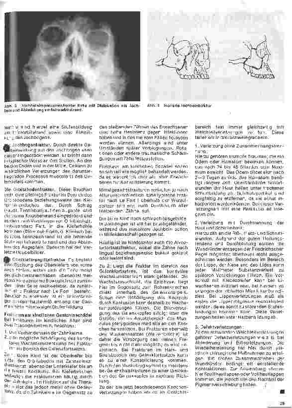 Vorschauseite 4: Zahn-Mundund Kieferchirurgie 8. Folge: Traumatologie I