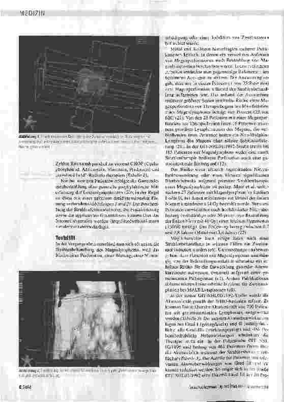 Vorschauseite 5: Strahlentherapie primärer gastrointestinalerNon-Hodgkin-Lymphome