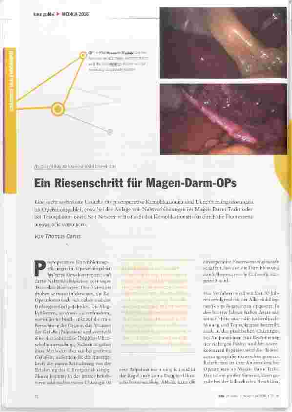Vorschauseite 1: Ein Riesenschritt für Magen-Darm-OPs