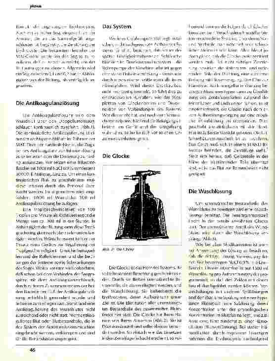 Vorschauseite 2: Hämolyse - Folge unsachgemäßer maschineller Autotransfusion