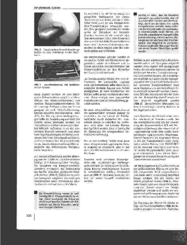 Vorschauseite 5: Stand und Trends in der biologischen Rekonstruktion von Knorpelschäden des Kniegelenks