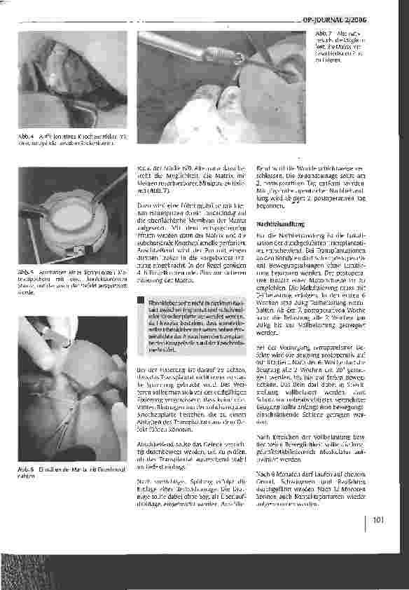 Vorschauseite 6: Stand und Trends in der biologischen Rekonstruktion von Knorpelschäden des Kniegelenks