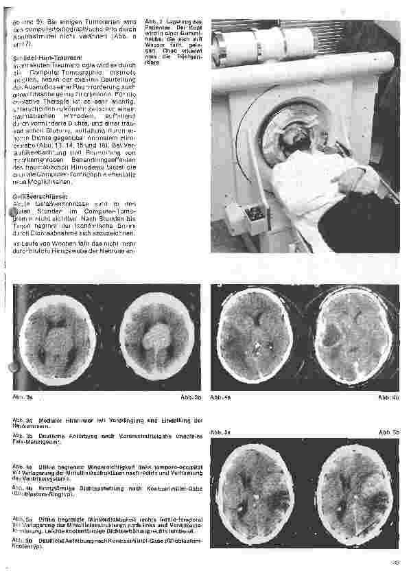 Vorschauseite 2: Themen aus der Neurochirurgie 3. Folge: Die craniale Computer-Tomographie - ein Fortschritt