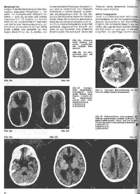 Vorschauseite 5: Themen aus der Neurochirurgie 3. Folge: Die craniale Computer-Tomographie - ein Fortschritt