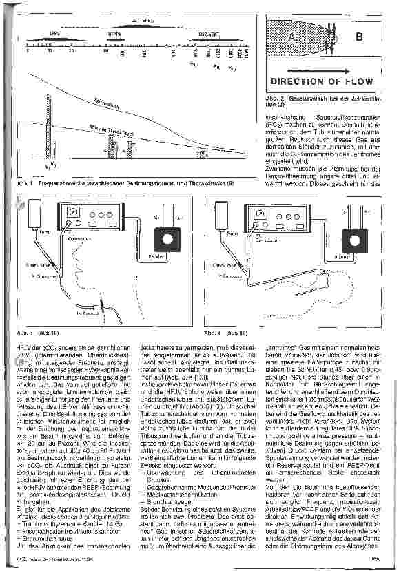 Vorschauseite 2: Einsatz der High-Frequency-Jet-Ventilation auf der Intensivstation