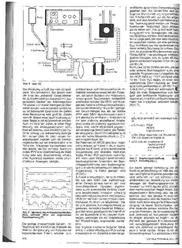 Vorschauseite 3: Einsatz der High-Frequency-Jet-Ventilation auf der Intensivstation