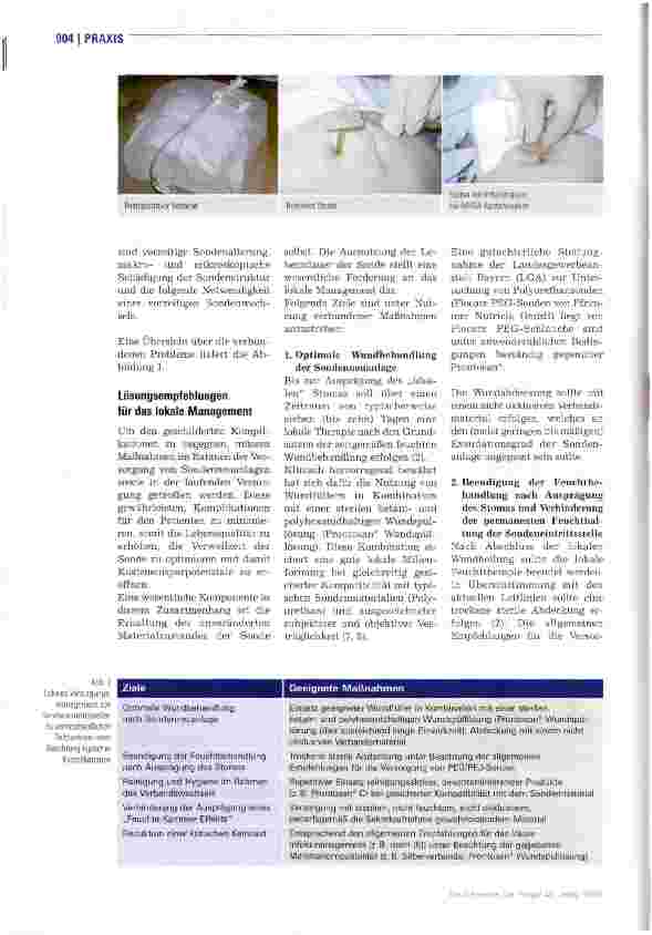 Vorschauseite 3: Versorgung und Pflege der Eintrittsstellen von PEG/PEJ-Sonden