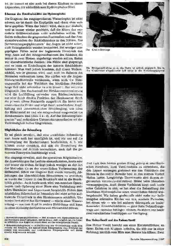 Vorschauseite 2: Der Hydrozephalus