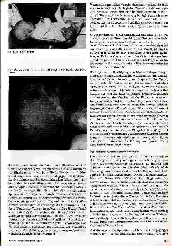 Vorschauseite 3: Der Hydrozephalus