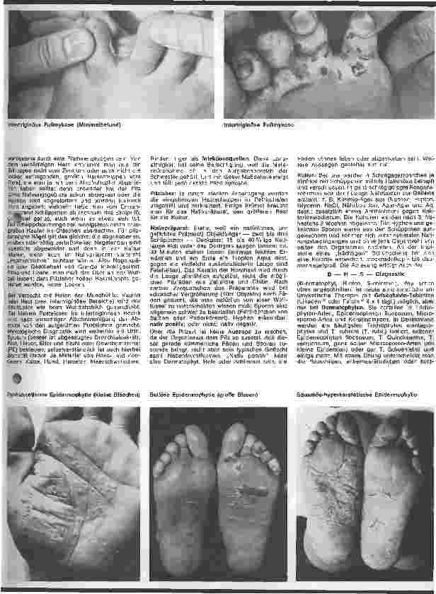 Vorschauseite 2: Der hautkranke Patient 11. Folge: Spezielle Dermatologie: Erregerbedingte Hauterkrankungen
