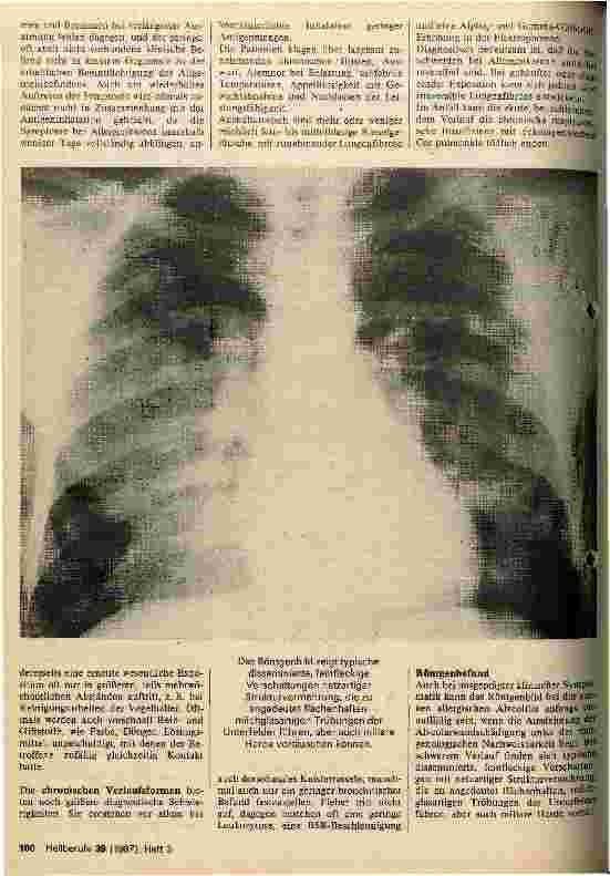 Vorschauseite 2: Die exogen allergische Alveolitis