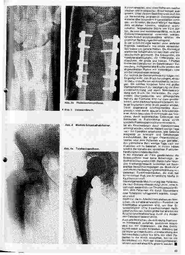 Vorschauseite 2: Metallische Implantate in der Unfallchirurgie