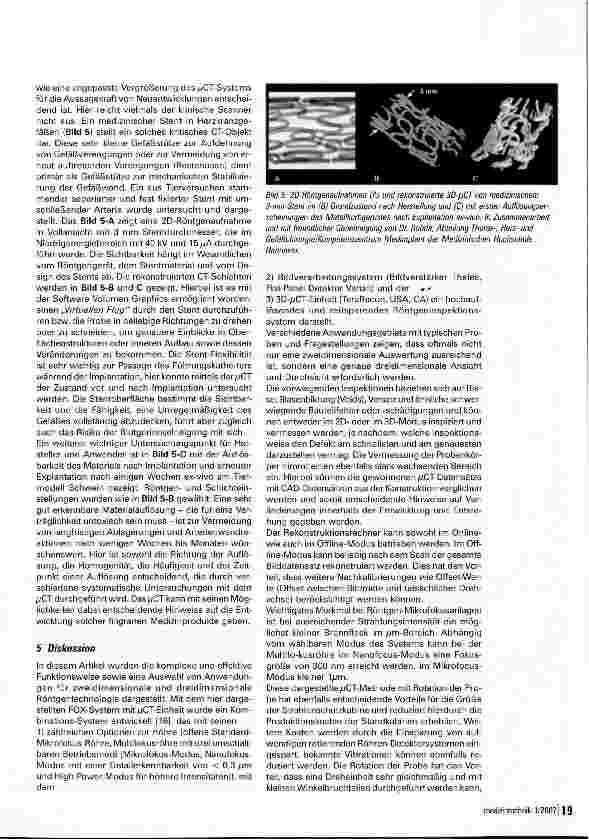 Vorschauseite 5: Axiale Mikrofokus Computertomographie (JL/ACT)Fast nichts bleibt verborgen