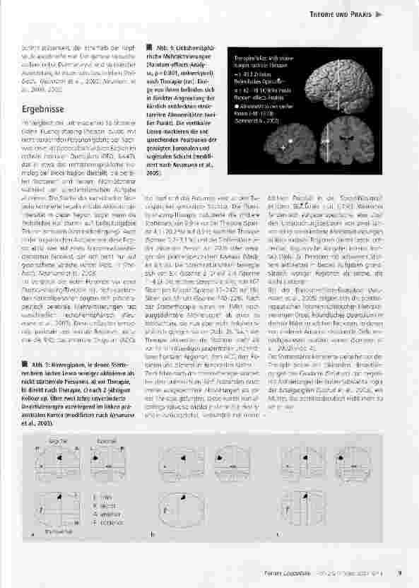 Vorschauseite 4: Stottern im Gehirn: neue Erkenntnisse aus Humangenetikund Neurowissenschaften