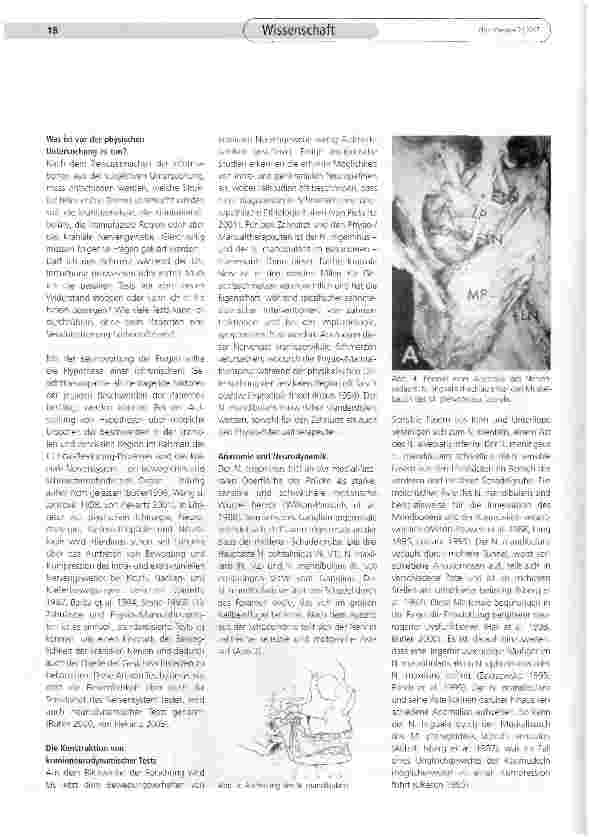 Vorschauseite 4: Gesichtsschmerzen und der neuro-dynamische Test des N. mandibularis