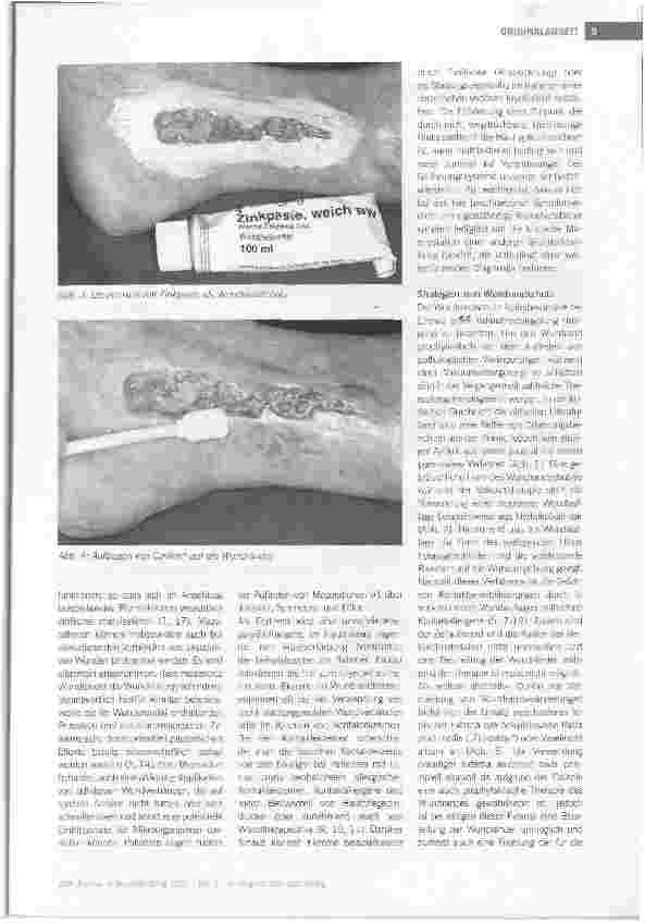 Vorschauseite 4: Wundrandschutz mit Cavilon® während Vakuumversiegelung: Resultate einer klinischen Untersuchung bei Patienten mit Ulcus cruris