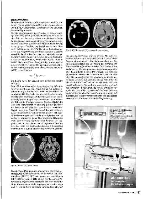 Vorschauseite 4: Darstellung multimodaler Daten des Gehirns