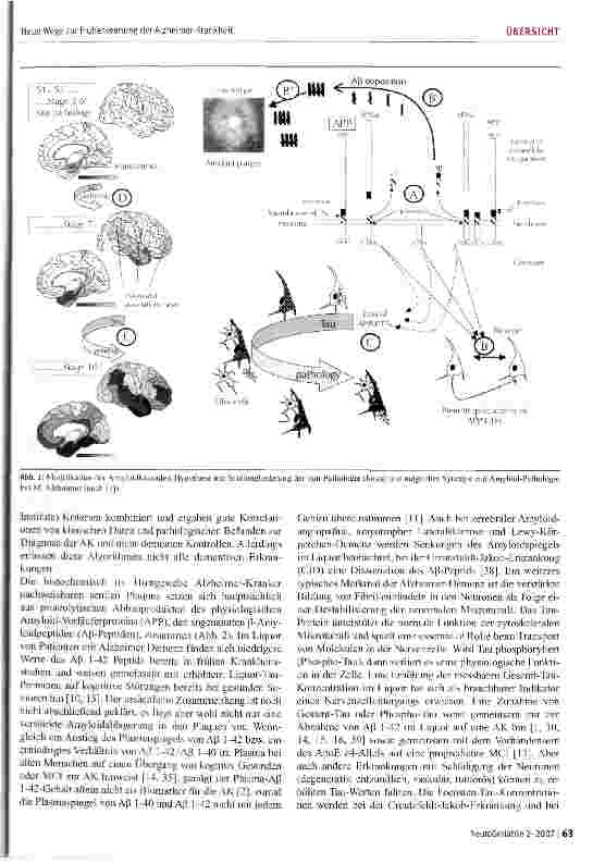 Vorschauseite 3: Neue Wege zur Früherkennung der Alzheimer-Krankheit: ALZheimer ASsociated Gene und Biomarker im Blut