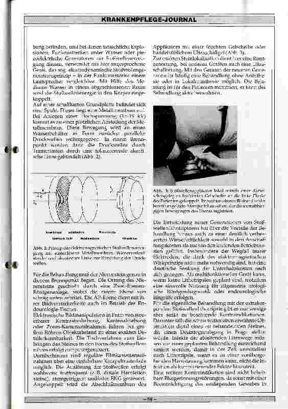 Vorschauseite 3: Lokale Stoßwellenlithotripsie mit einem Lithitriptor der zweiten Generation