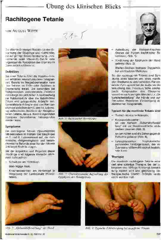 Vorschauseite 1: Rachitogene Tetanie