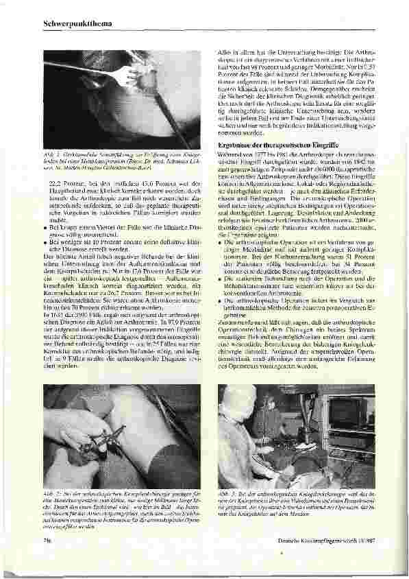 Vorschauseite 2: Arthroskopie und arthroskopische Operation des Kniegelenks