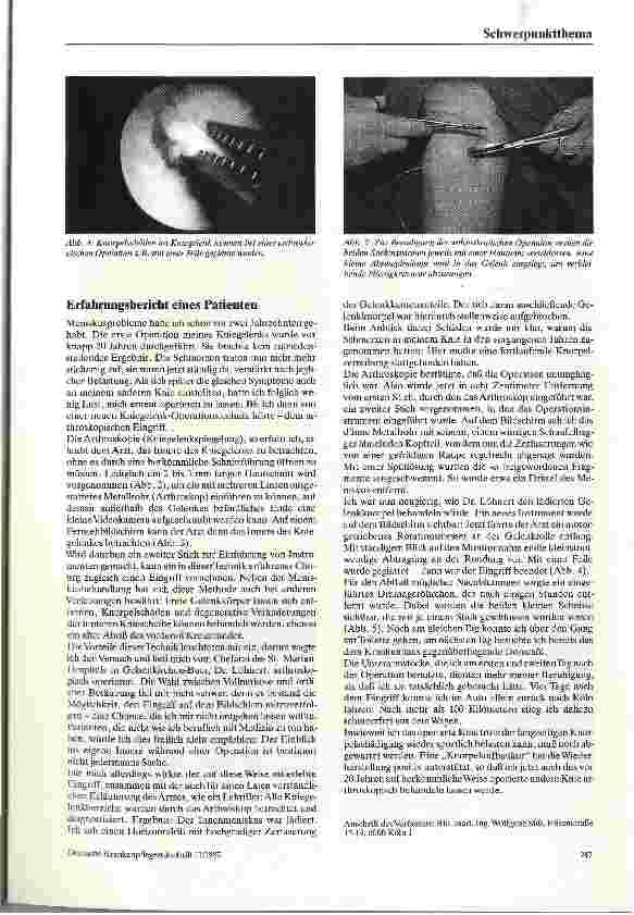 Vorschauseite 3: Arthroskopie und arthroskopische Operation des Kniegelenks
