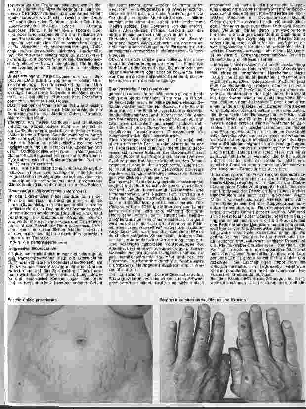 Vorschauseite 2: Der hautkranke Patient 16. Folge: Spezielle Dermatologie: Erkrankungen des Bindegewebes, Störung im Stoffwechsel