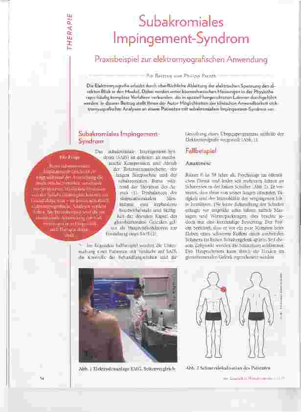 Vorschauseite 1: Subakromiales Impingement-Syndrom