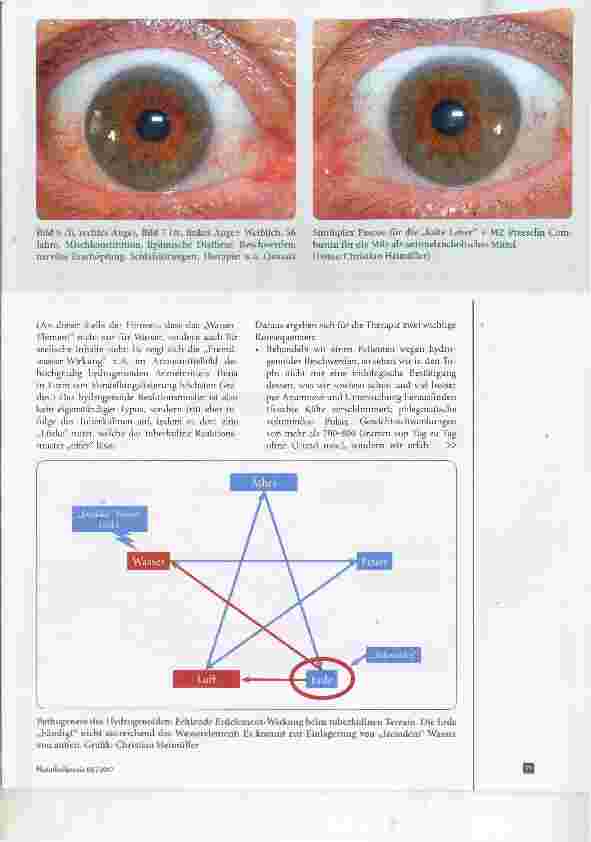 Vorschauseite 6: Die Konstitutionslehre der Irisdiagnose auf dem „Prüfstand“ Teil II