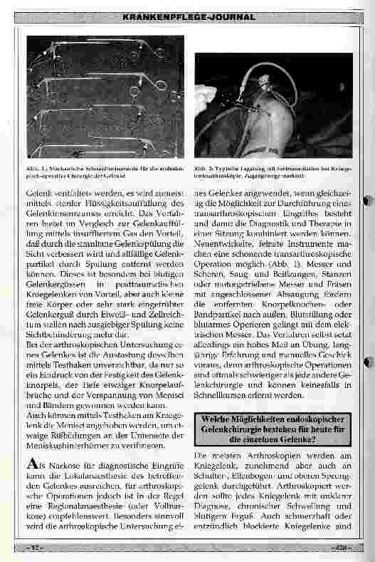 Vorschauseite 2: Möglichkeiten der endoskopischen Gelenkoperationen