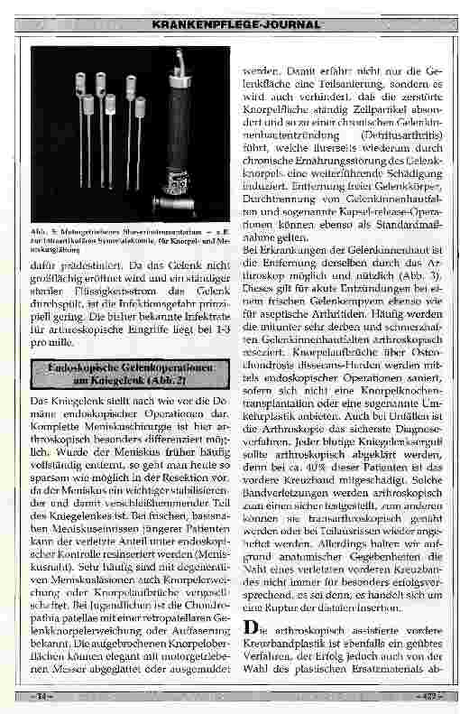 Vorschauseite 3: Möglichkeiten der endoskopischen Gelenkoperationen