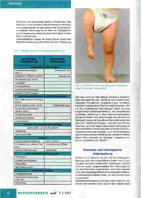 Vorschauseite 2: Wissenswertes für die PraxisBeinlängendifferenzenUntersuchung und Therapie