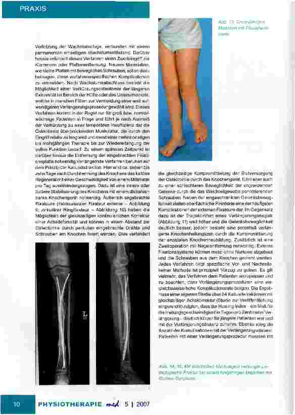 Vorschauseite 6: Wissenswertes für die PraxisBeinlängendifferenzenUntersuchung und Therapie