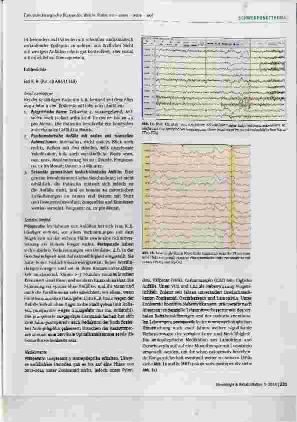 Vorschauseite 2: Epilepsiechirurgische Diagnostik: Welche Patienten wann wozu wo?