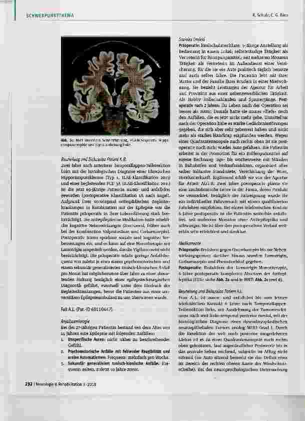 Vorschauseite 3: Epilepsiechirurgische Diagnostik: Welche Patienten wann wozu wo?